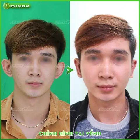 Tướng Tai Vểnh Tướng Tai Vểnh