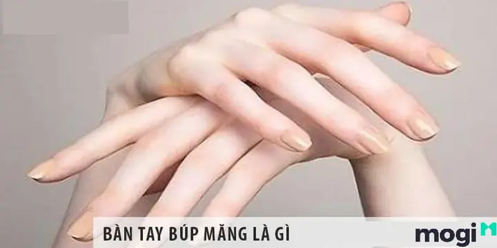 Tướng Tay Búp Măng