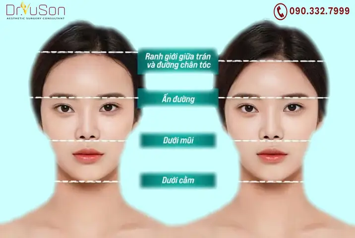 Tướng Trán Cao Cằm Ngắn
