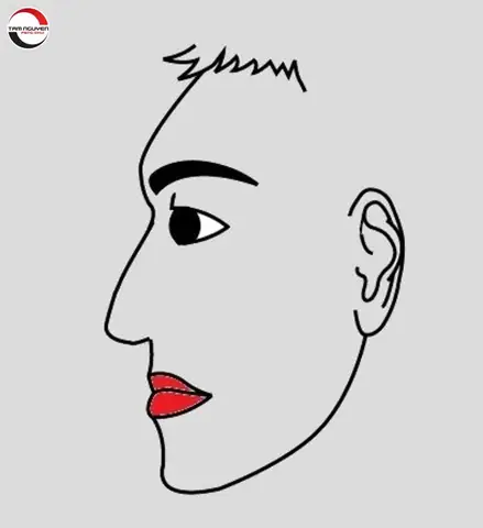 Tướng Trán Trợt