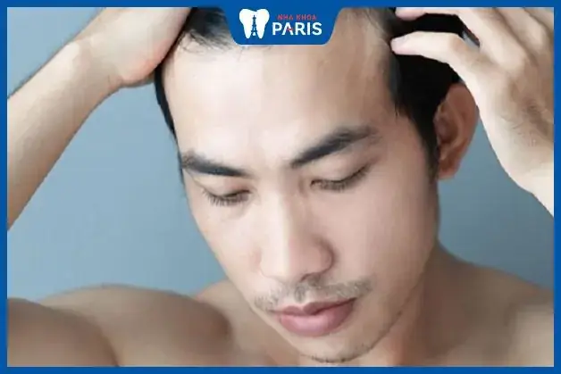 Tướng Trán Trợt