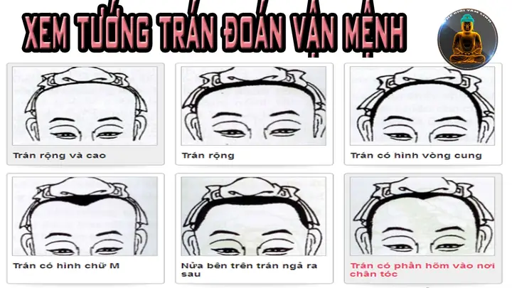 Tướng Trán Vuông Phụ Nữ Tướng Trán Vuông Phụ Nữ