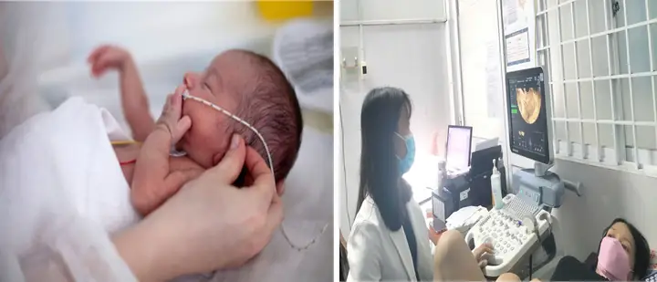 Ử Vi Tướng Số Cổ Ngắn Cổ Dài