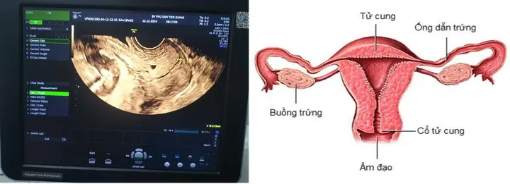 Ử Vi Tướng Số Cổ Ngắn Cổ Dài Ử Vi Tướng Số Cổ Ngắn Cổ Dài