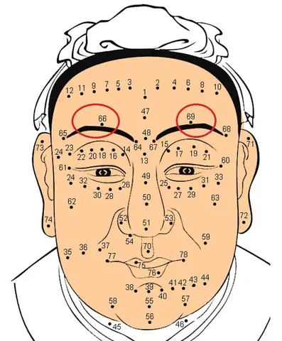 Vị Trí Nốt Ruồi Trong Nhân Tướng Học