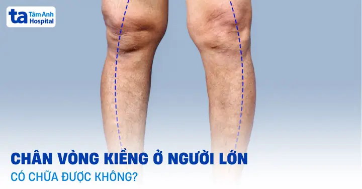 Xem Tướng Đàn Ông Chân Vòng Kiềng