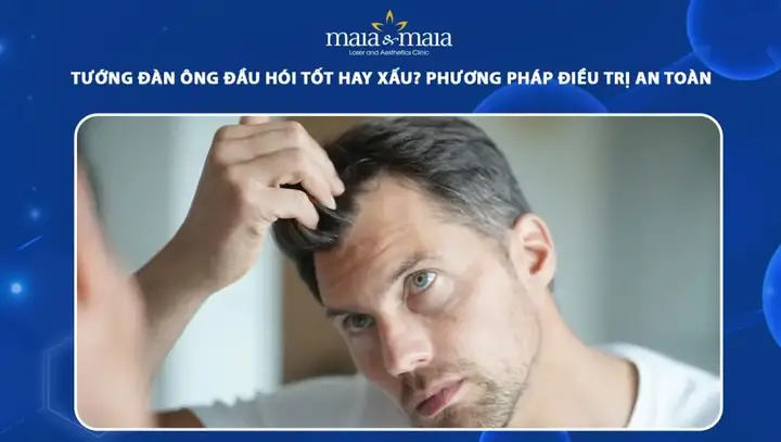 Xem Tướng Đàn Ông Đầu Hói