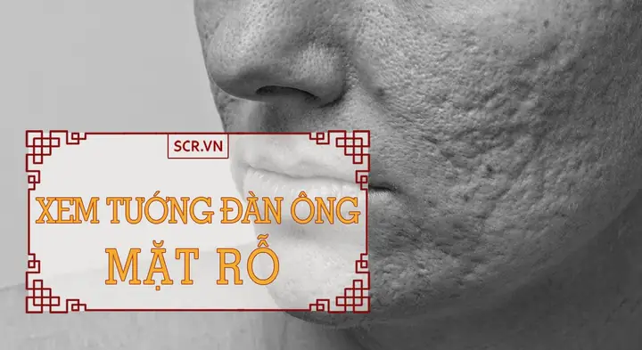 Xem Tướng Đàn Ông Mặt Rỗ
