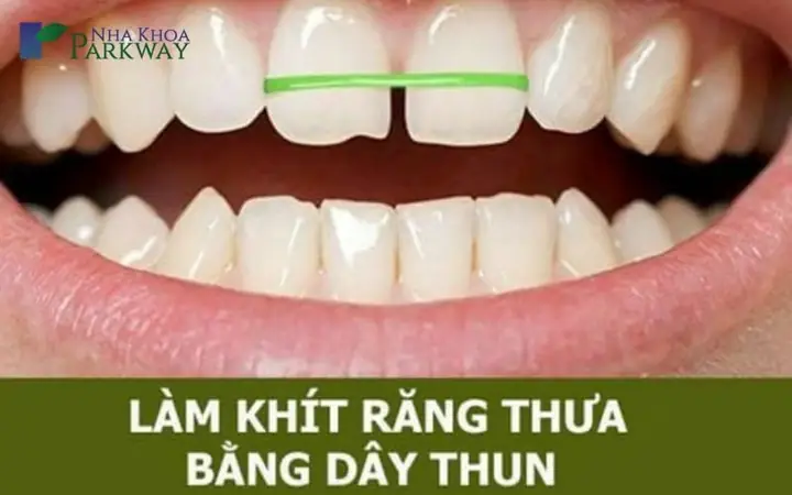 Xem Tướng Đàn Ông Răng Thưa