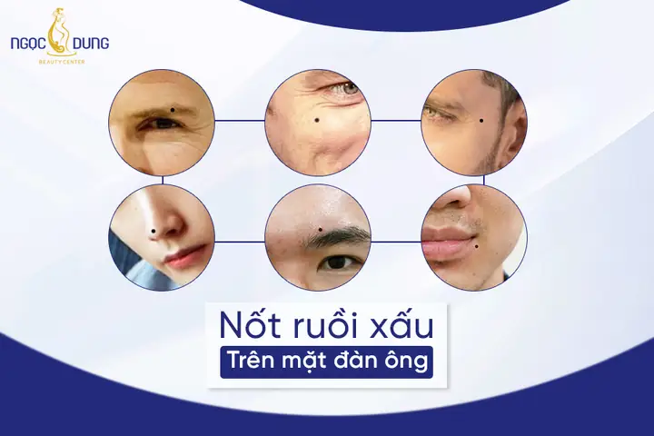Xem Tướng Mặt Đàn Ông Xấu