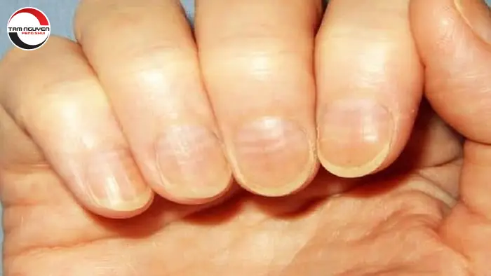 Xem Tướng Móng Tay Đàn Ông